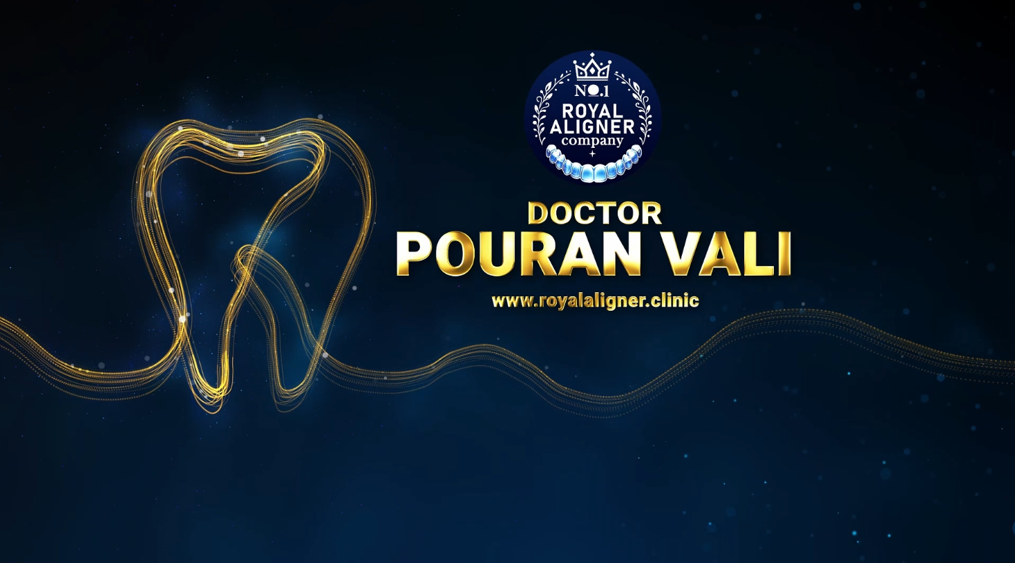 ما هي تقويمات رويال الشفافة المزودة بالملحقات؟